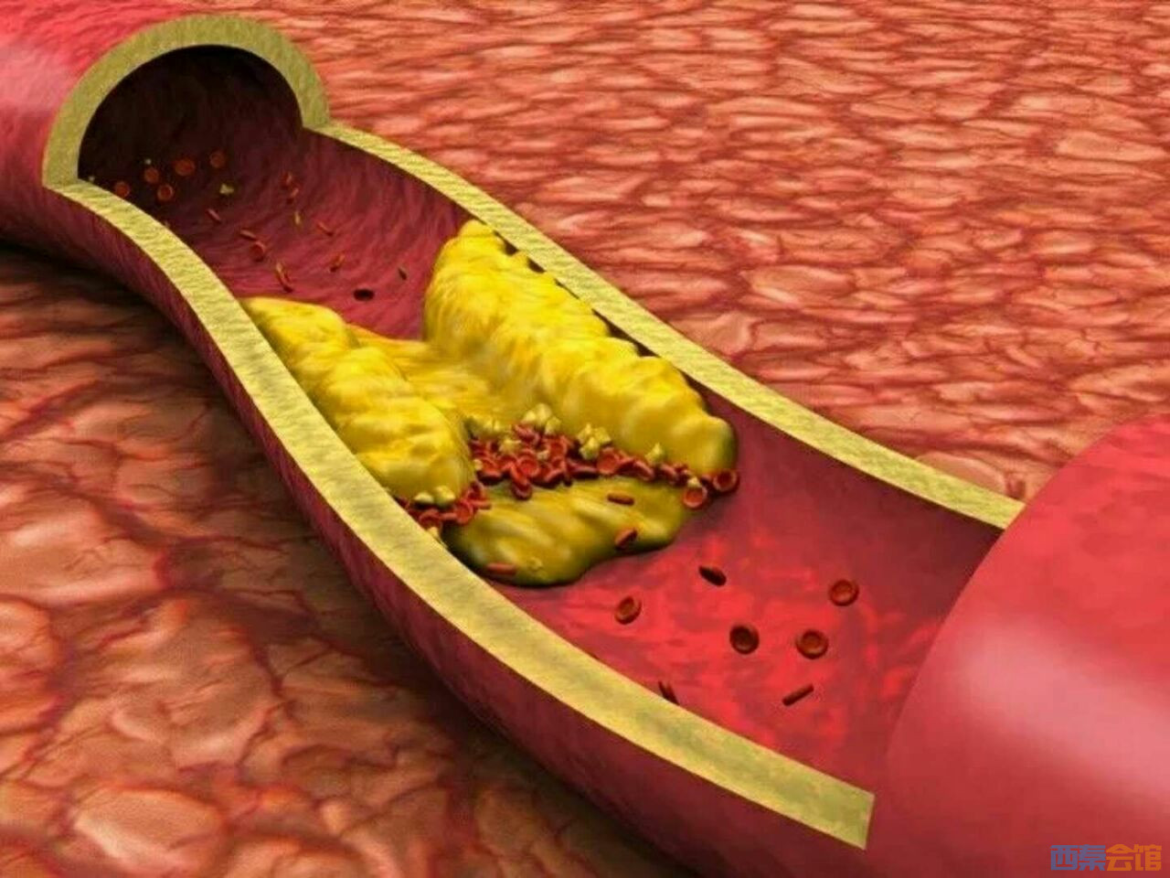 自贡三医院最新技术,让你远离瘫痪,重获新生