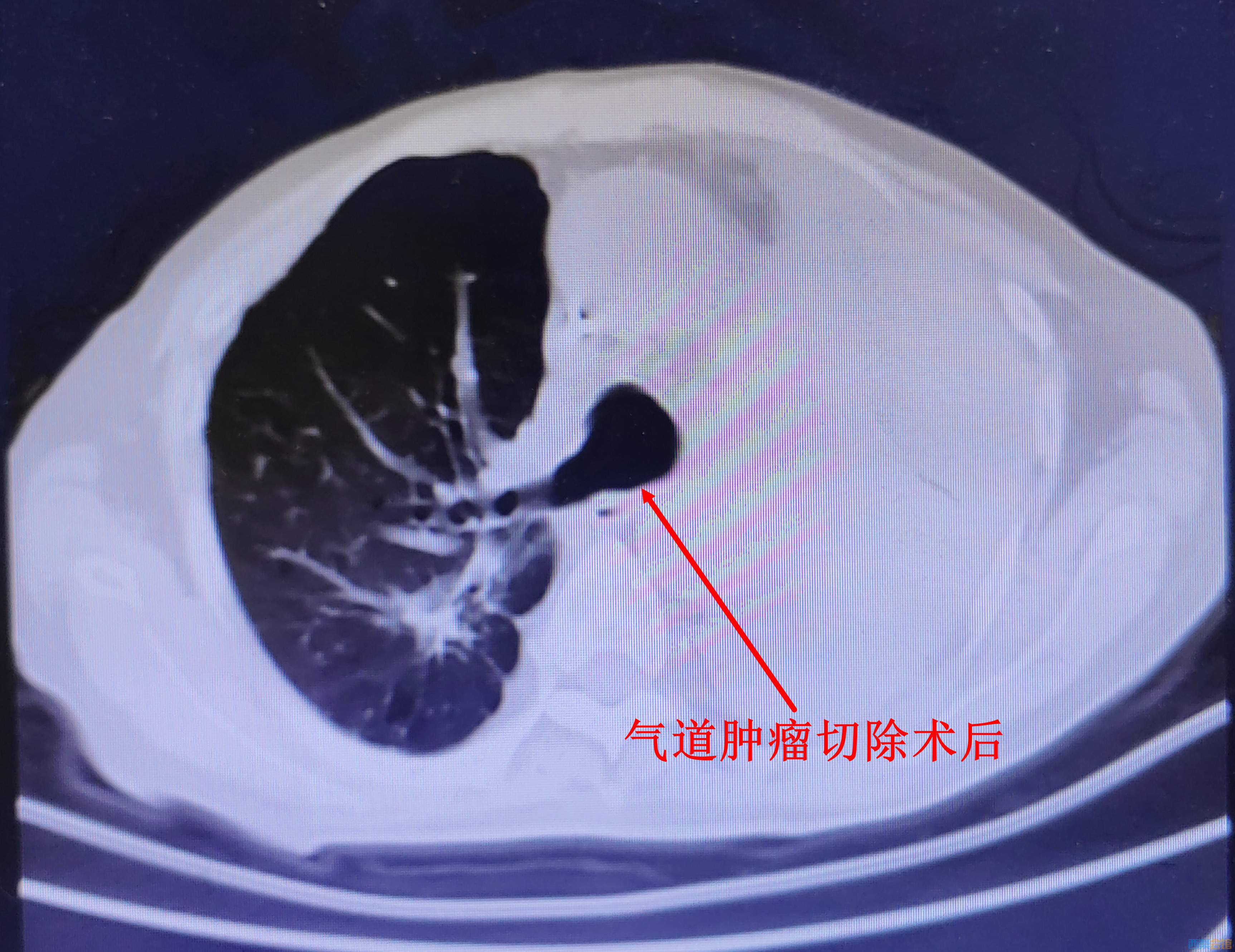 CT�δ����������г�����.jpg