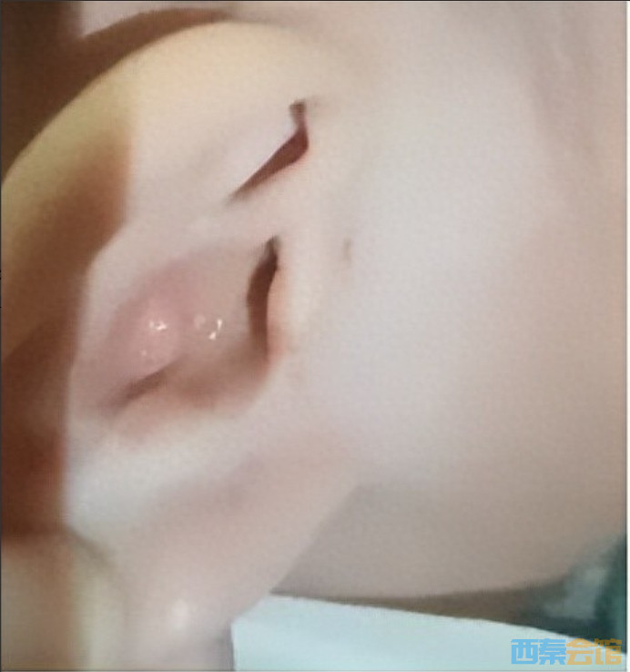 22.png