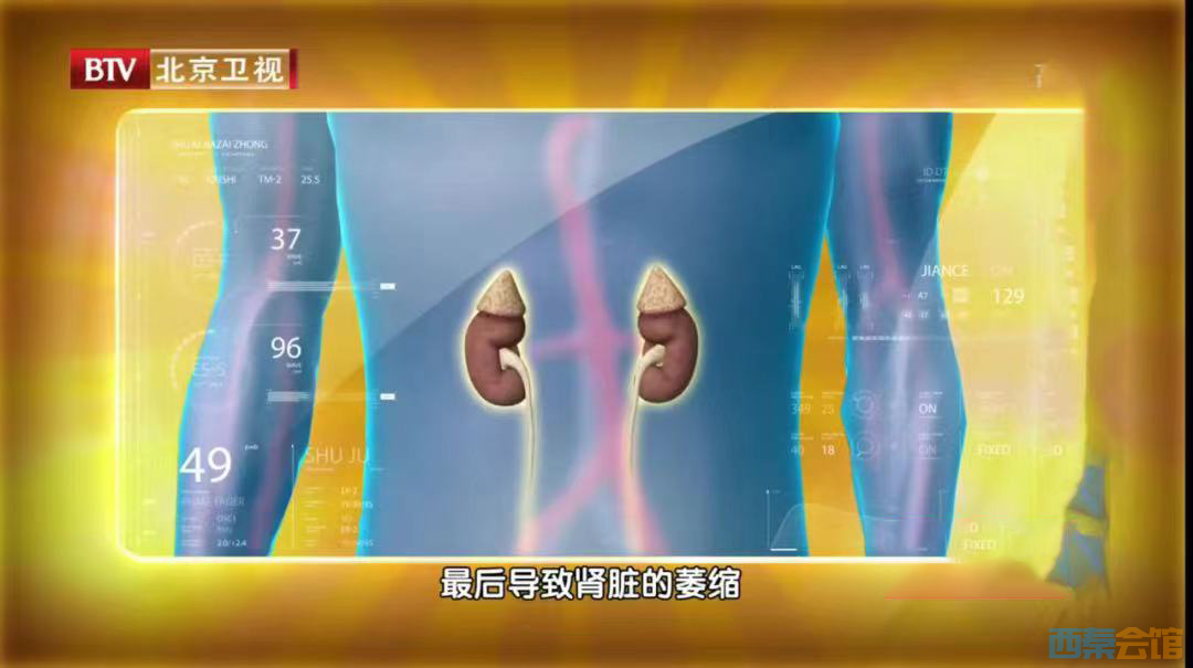 59.png