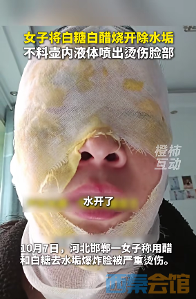 78.png